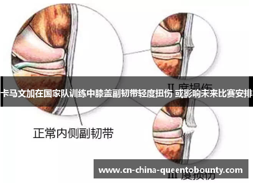 卡马文加在国家队训练中膝盖副韧带轻度扭伤 或影响未来比赛安排